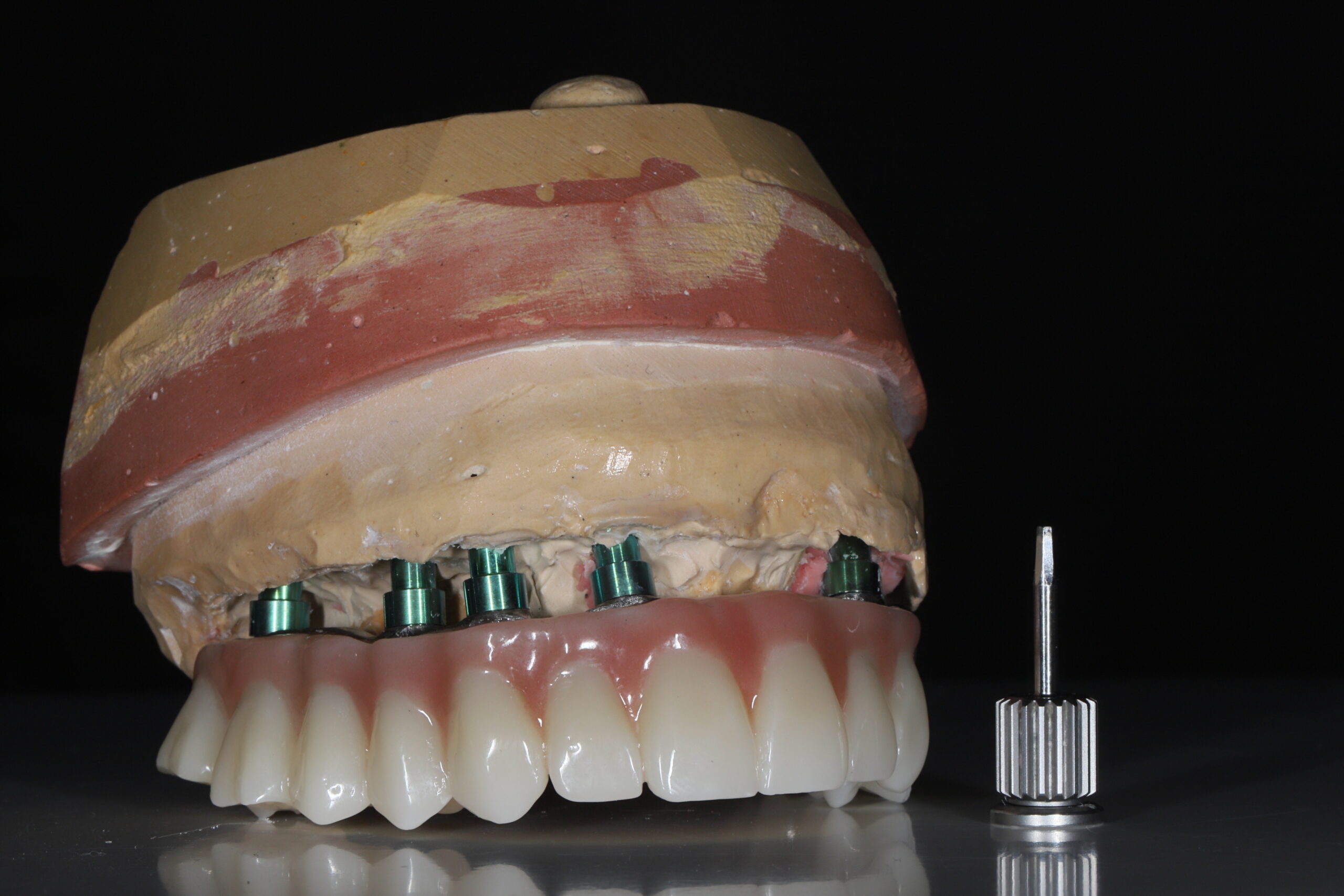 Full Arch Reconstruction: Advanced Oral Rehabilitation