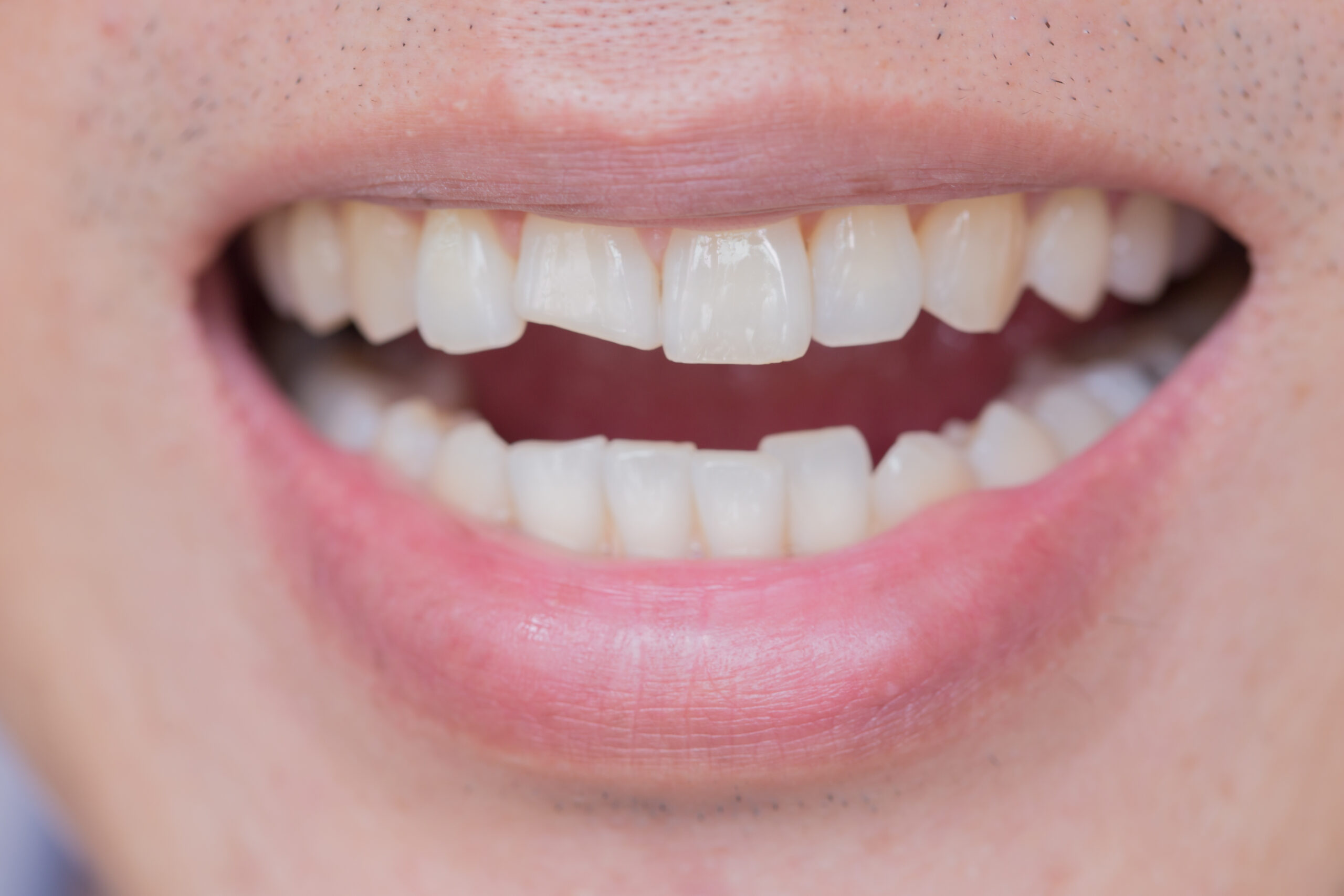 Advanced Treatment Options