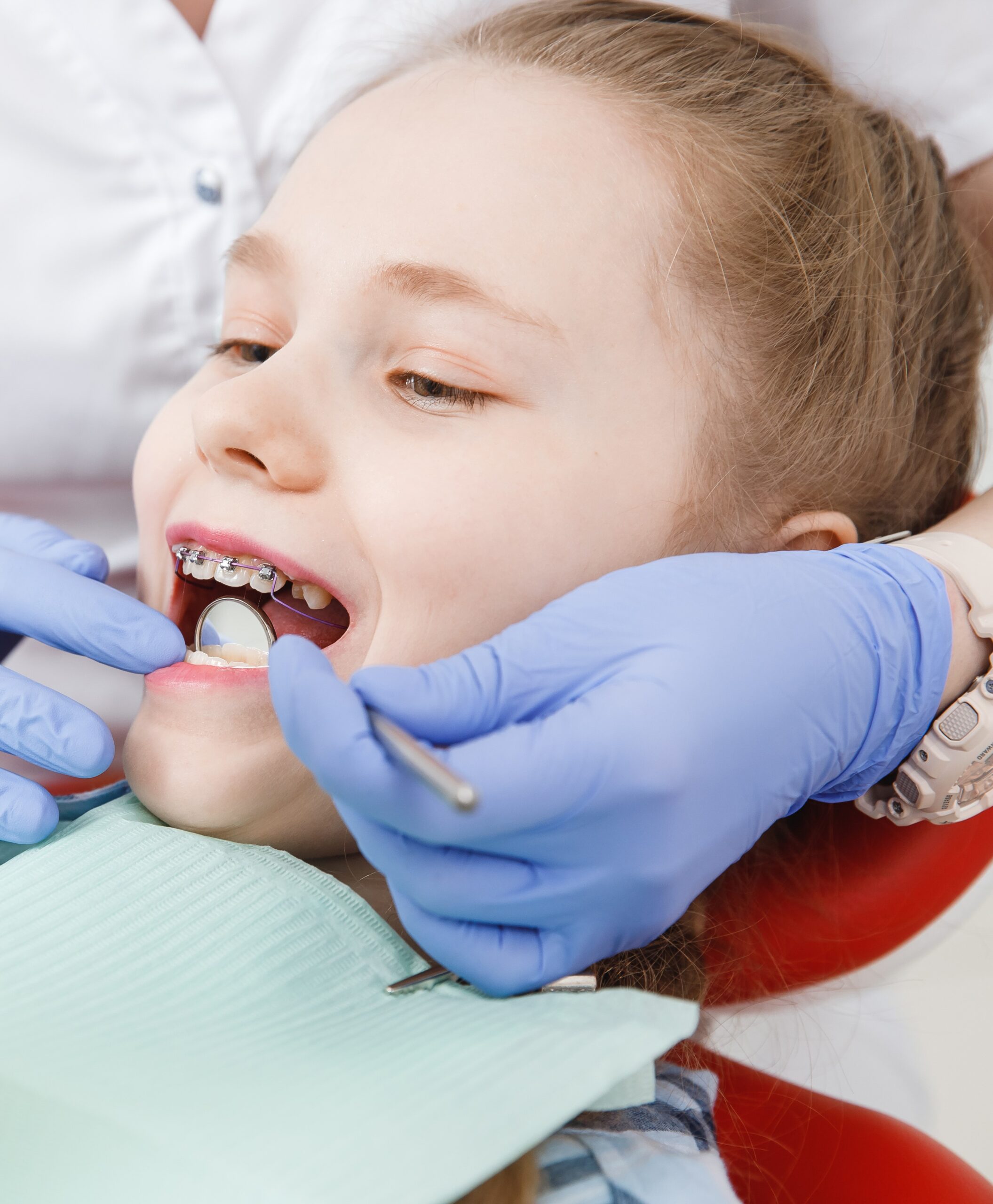 Children and Dental Trauma