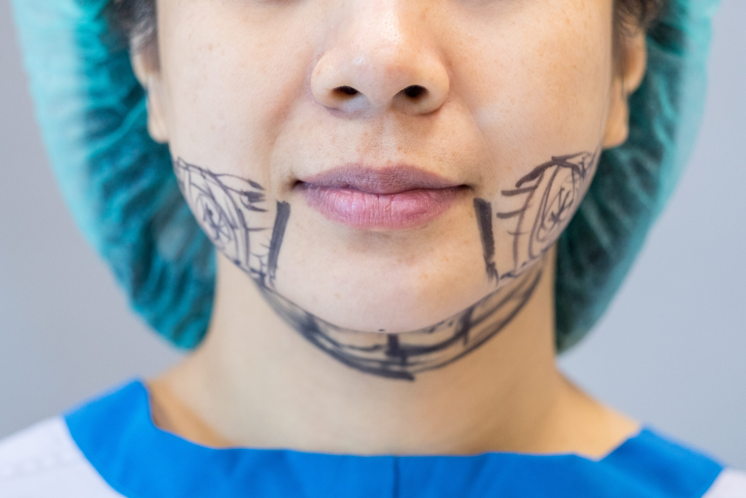 Conditions Treated with Orthognathic Surgery