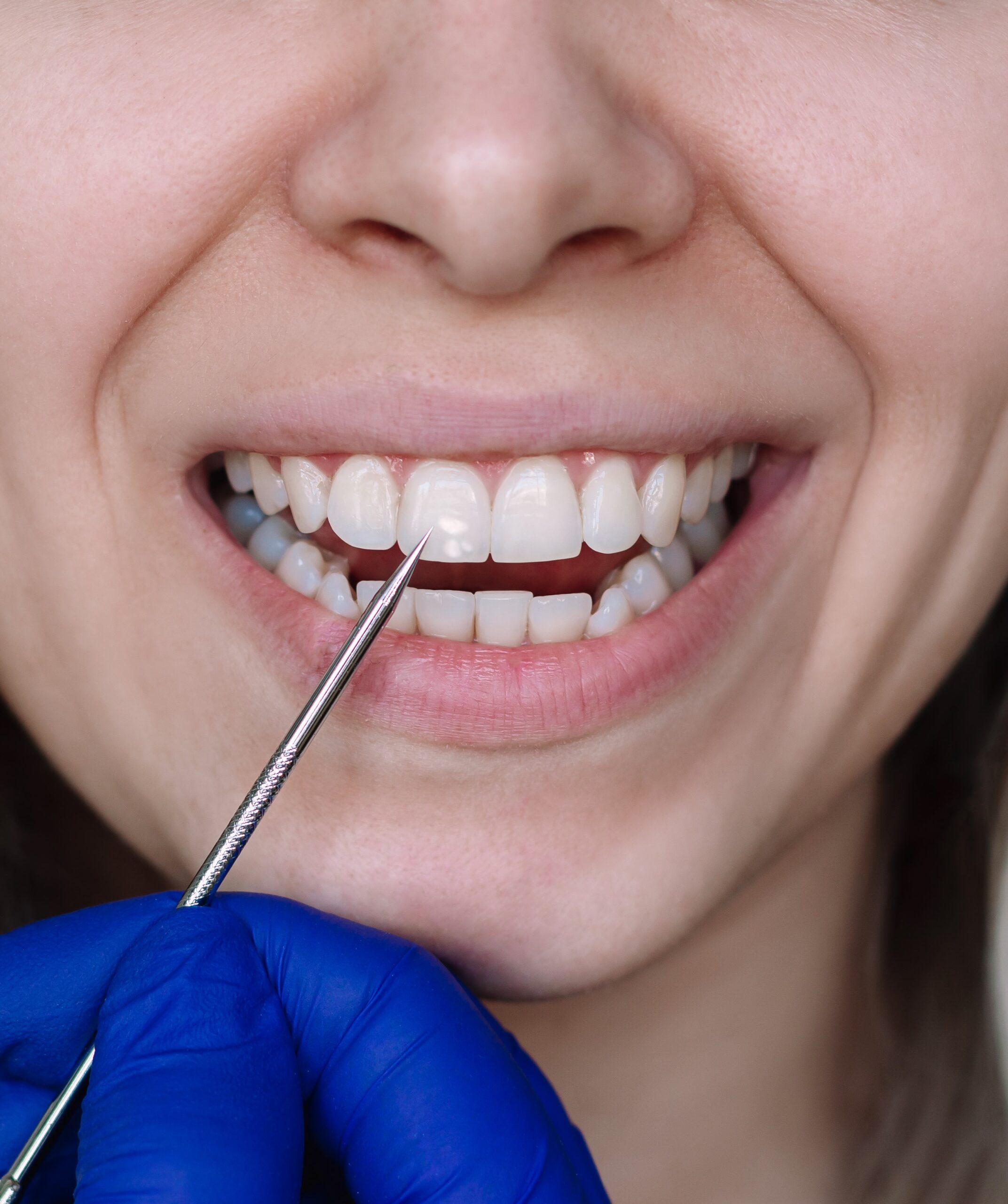 Types of Oral Pathology We Treat