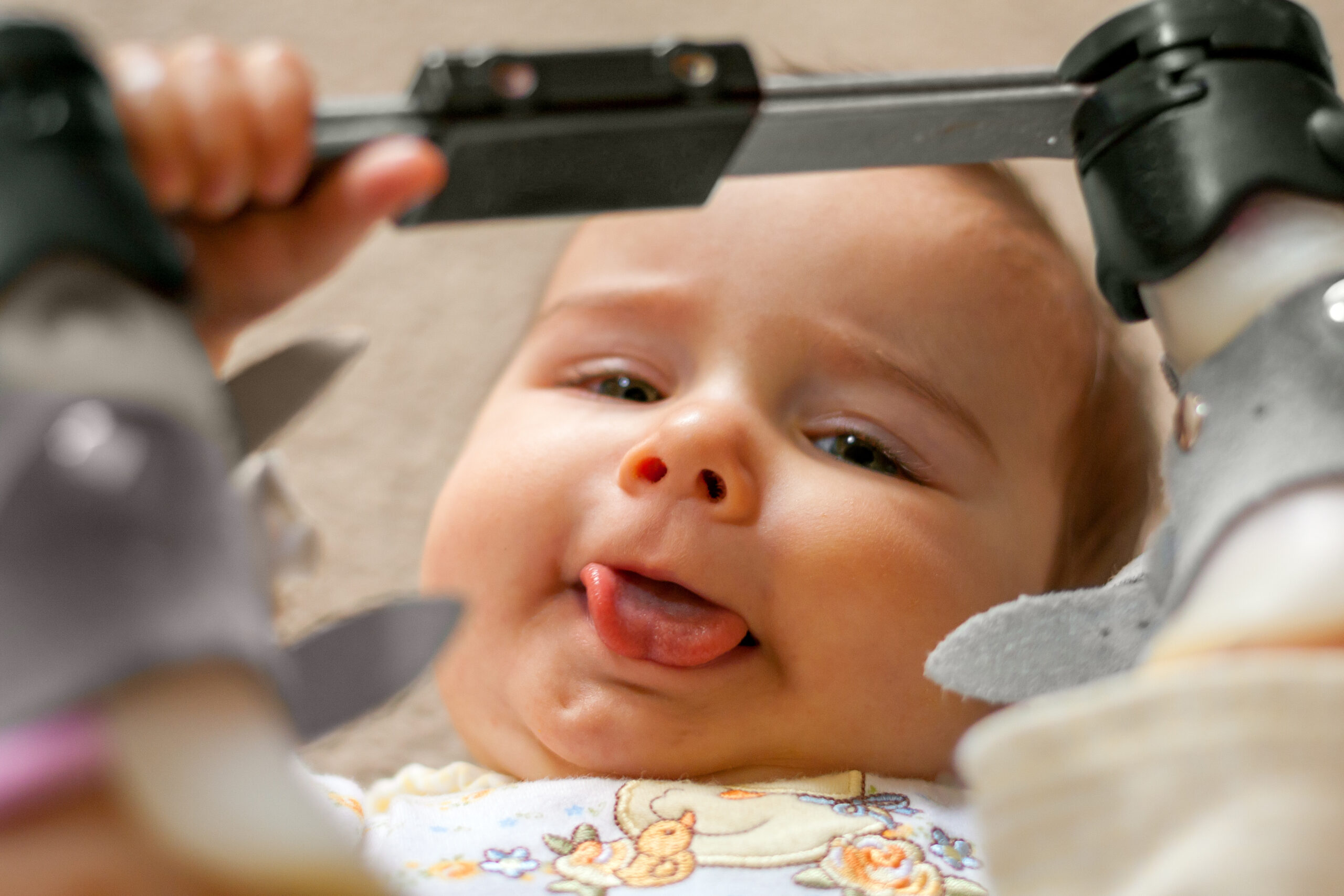 Frenectomy for Infants and Children